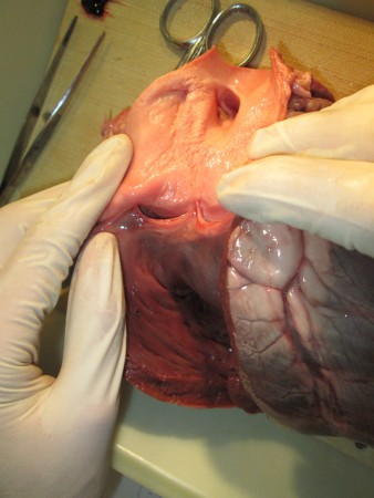 Valve de l'artère pulmonaire